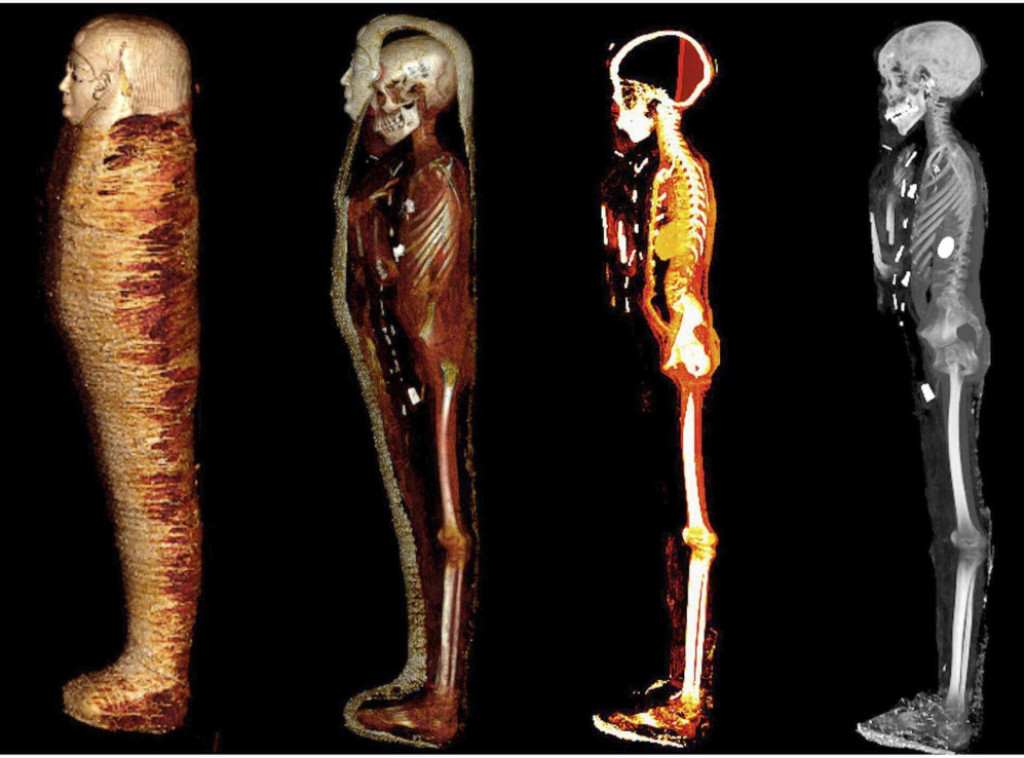 Arheolozi pronašli možda najstariju egipatsku mumiju