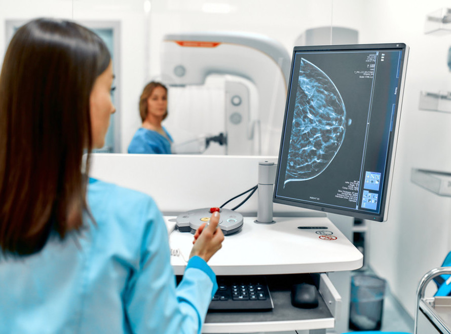 Institut "Batut" pokrenuo akciju mamografije u Zavodu za zdravlje "Železnice"