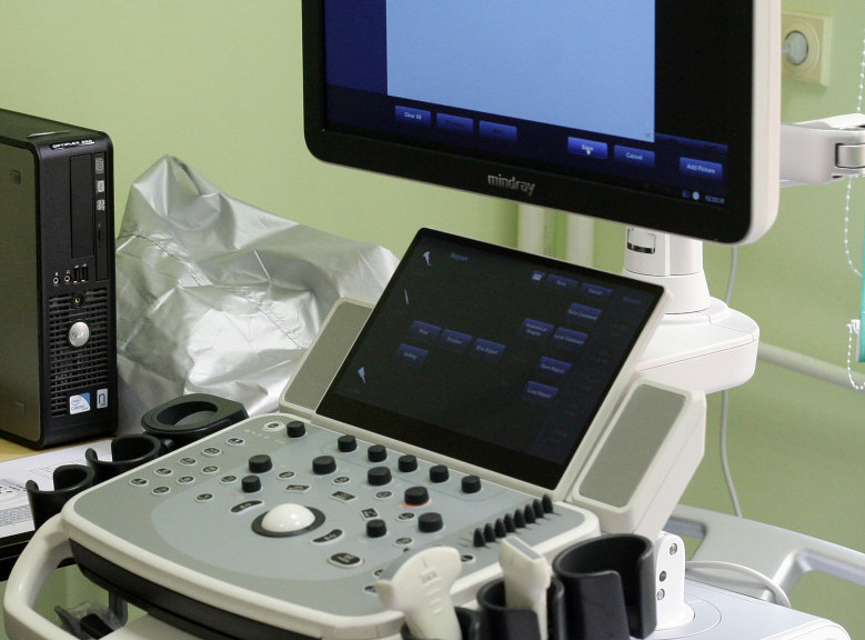 Niš: Besplatni ultrazvučni pregledi štitaste žlezde i karotida od 2. do 5. aprila