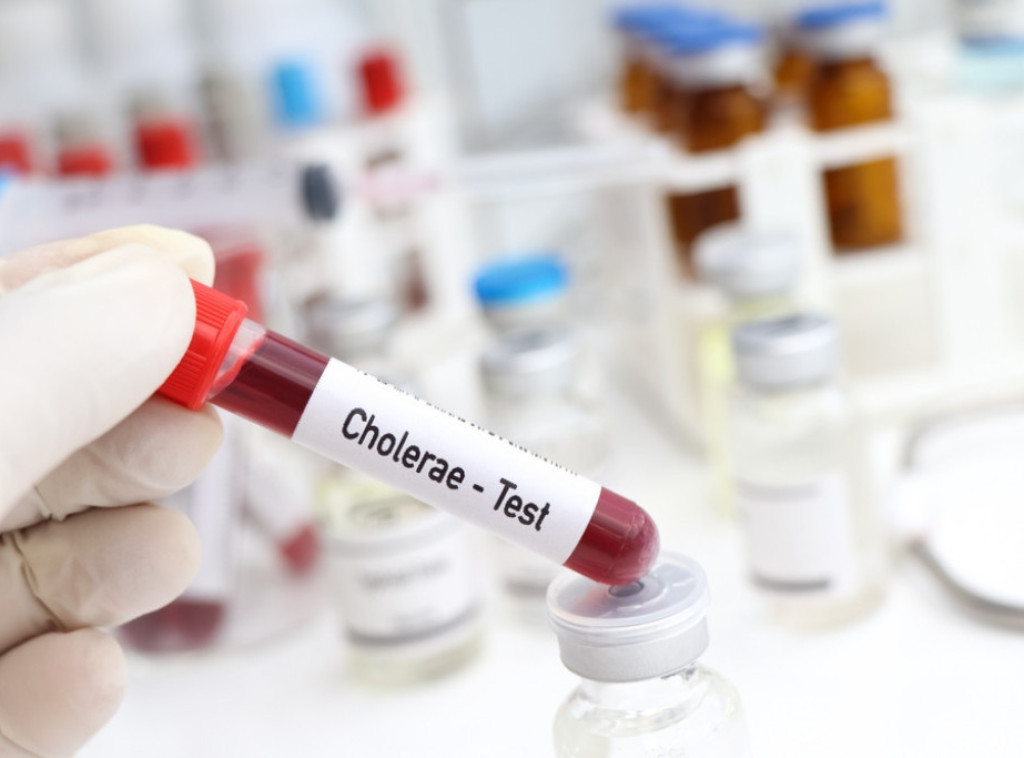 U epidemiji kolere u Nigeriji preminulo najmanje 74 osoba, zaraženo više od 7.800