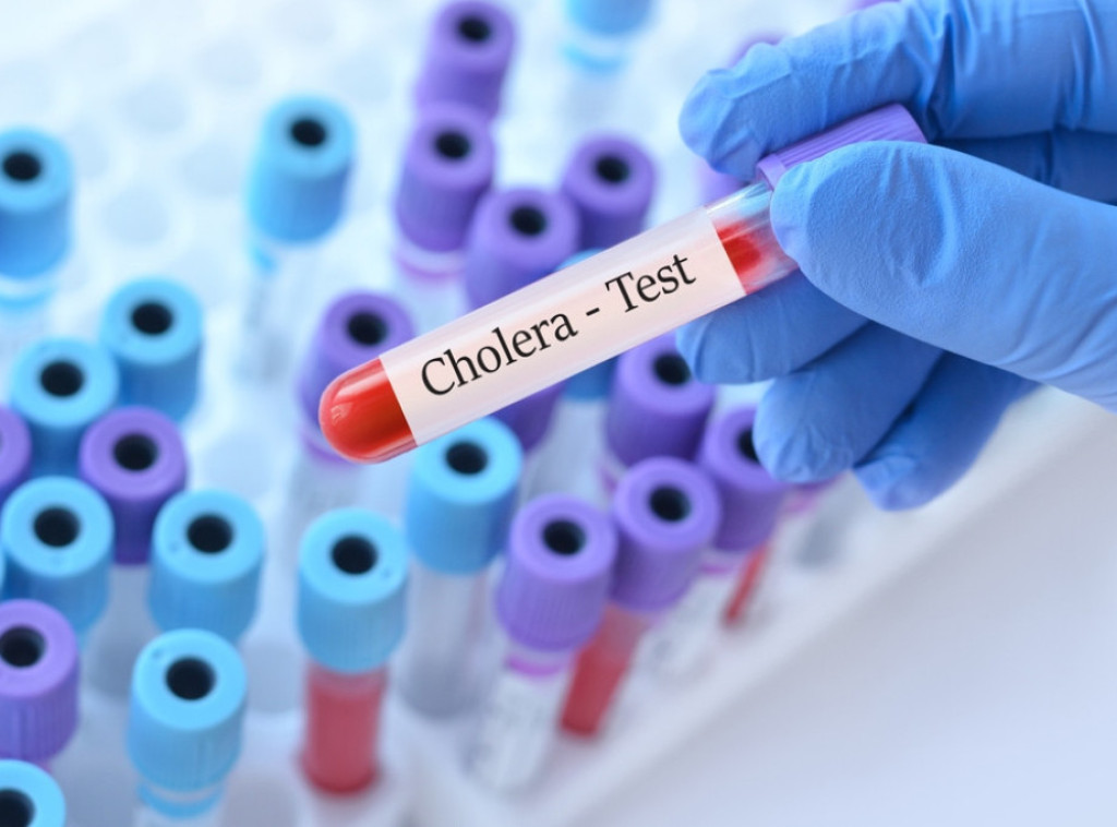 U Sudanu izbila epidemija kolere, više od 1.000 zaraženih, 58 preminulo