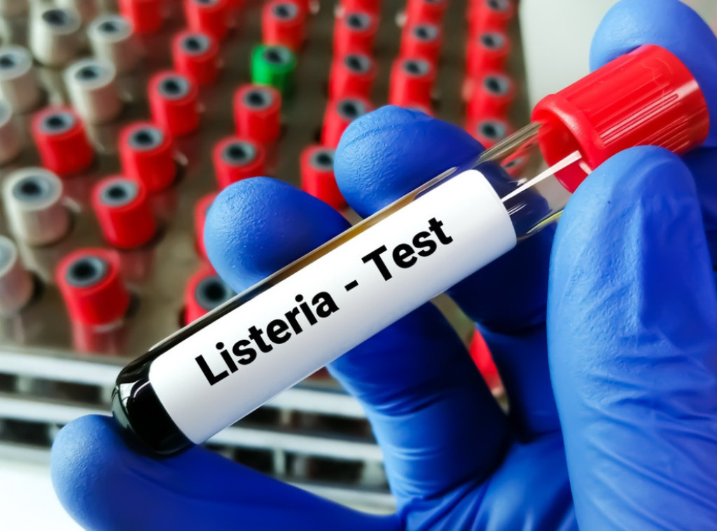 SAD: Epidemiju listerije, od koje je 12 ljudi umrlo, izazvali smrznuti šejkovi