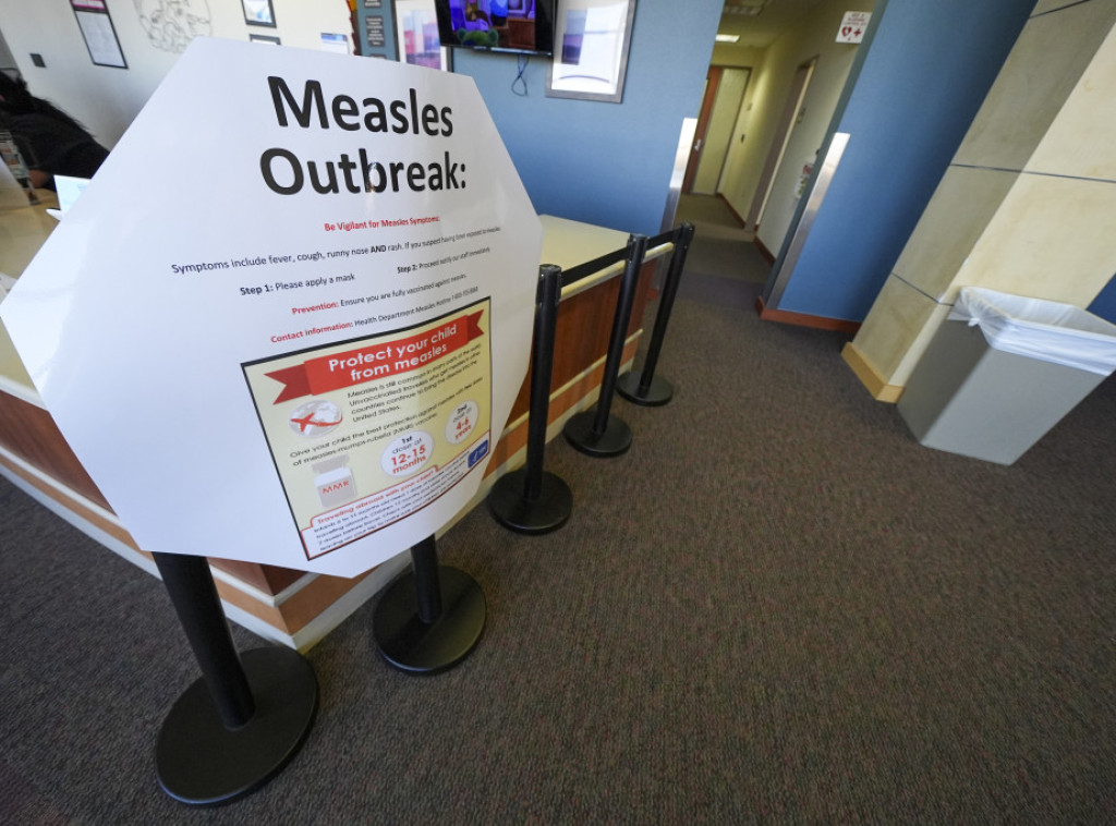 U Teksasu zabeležen treći smrtni slučaj od malih boginja