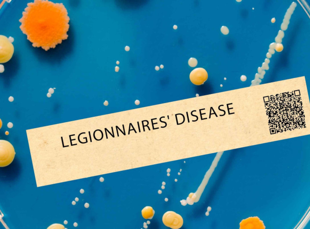 Crna Gora: Potvrđen jedan slučaj legionarske bolesti ovog leta