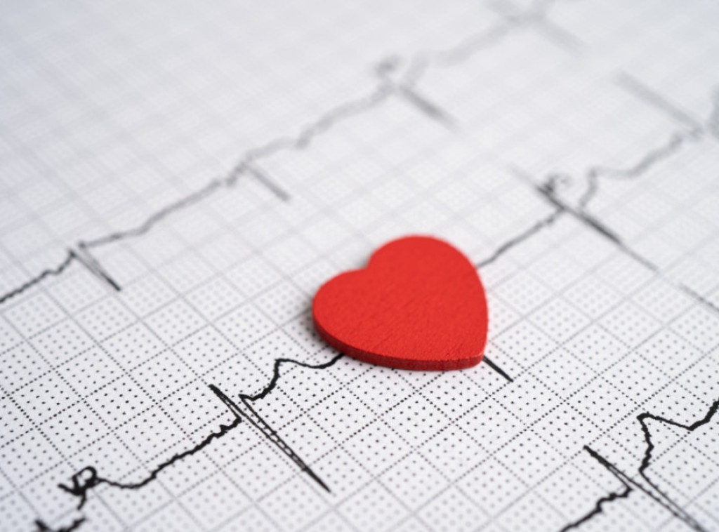 Kardiolog o "muškom i ženskom infarktu": Žene kasnije obolevaju, ali češće umiru