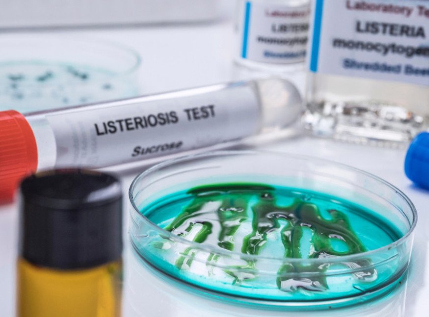 SAD: Najmanje 10 ljudi obolelo od listerioze nakon konzumiranja gotovih jela