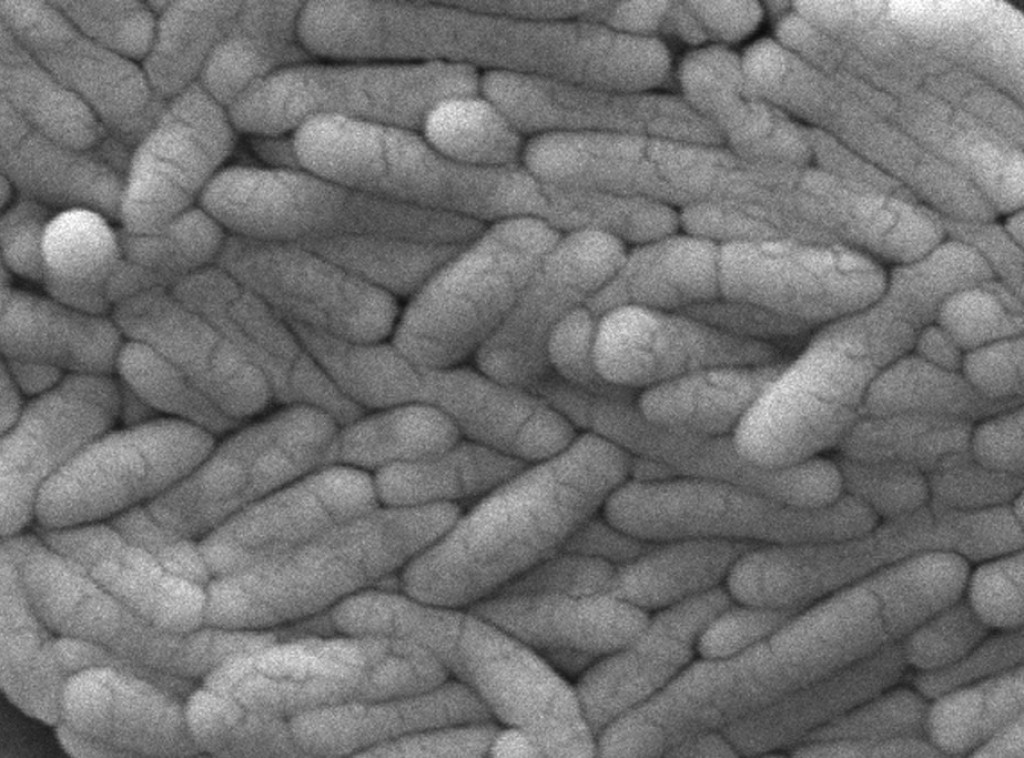 Izbijanje salmonele povezano s krastavcima proširilo se na 18 država SAD, 45 obolelih