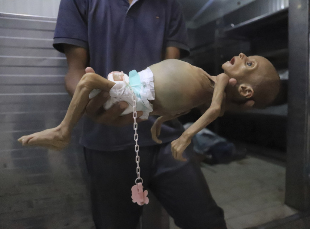 Više od 6.000 palestinske dece se leči od neuhranjenosti u Gazi