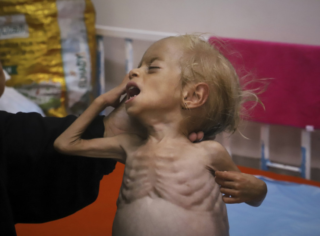 Izveštaj UN: Gotovo 13.000 dece hospitalizovano zbog akutne neuhranjenosti u Gazi