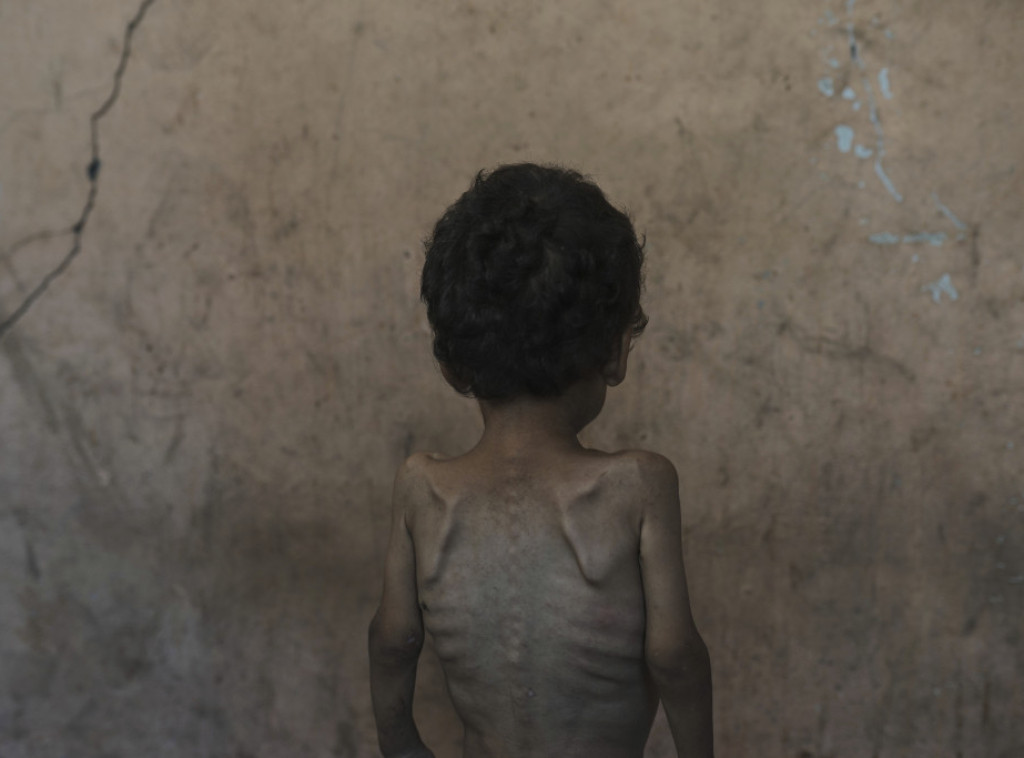 Ministarstvo zdravlja Gaze: Do danas 289 Palestinaca preminulo od gladi