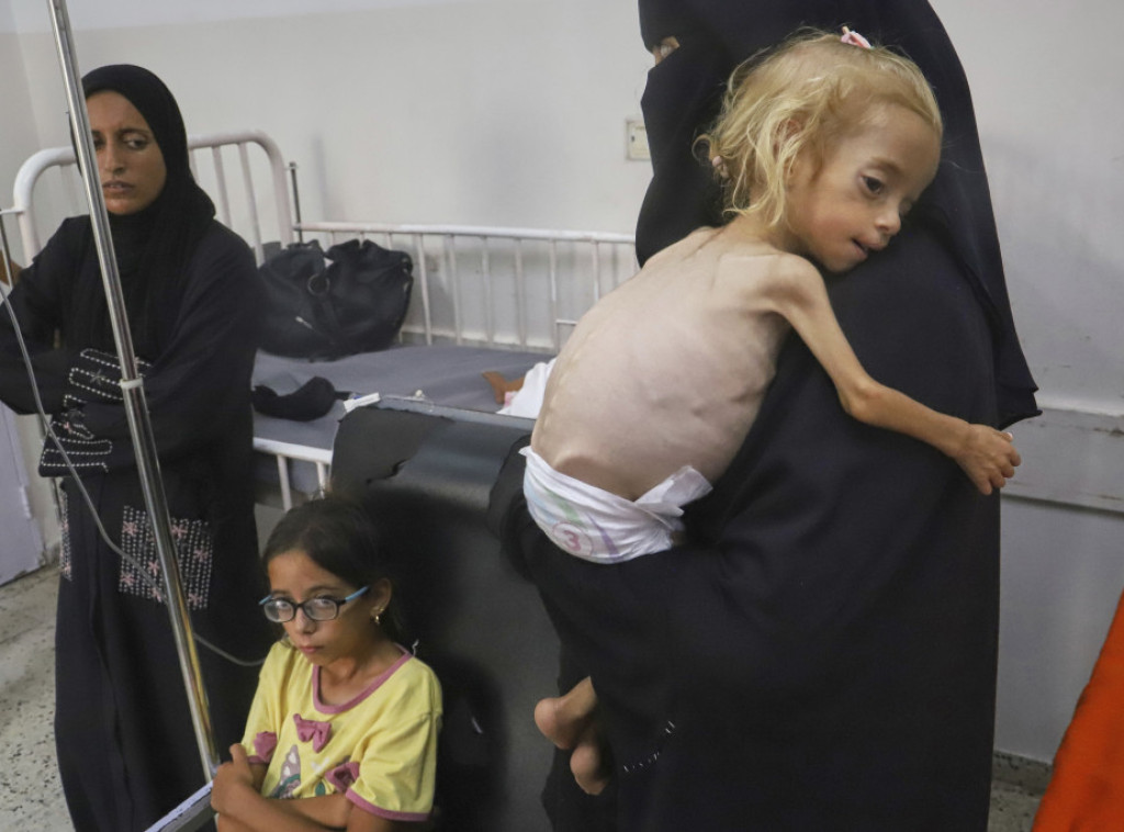 UN: Još tri Palestinca u Pojasu Gaze umrla od gladi za poslednja 24 sata