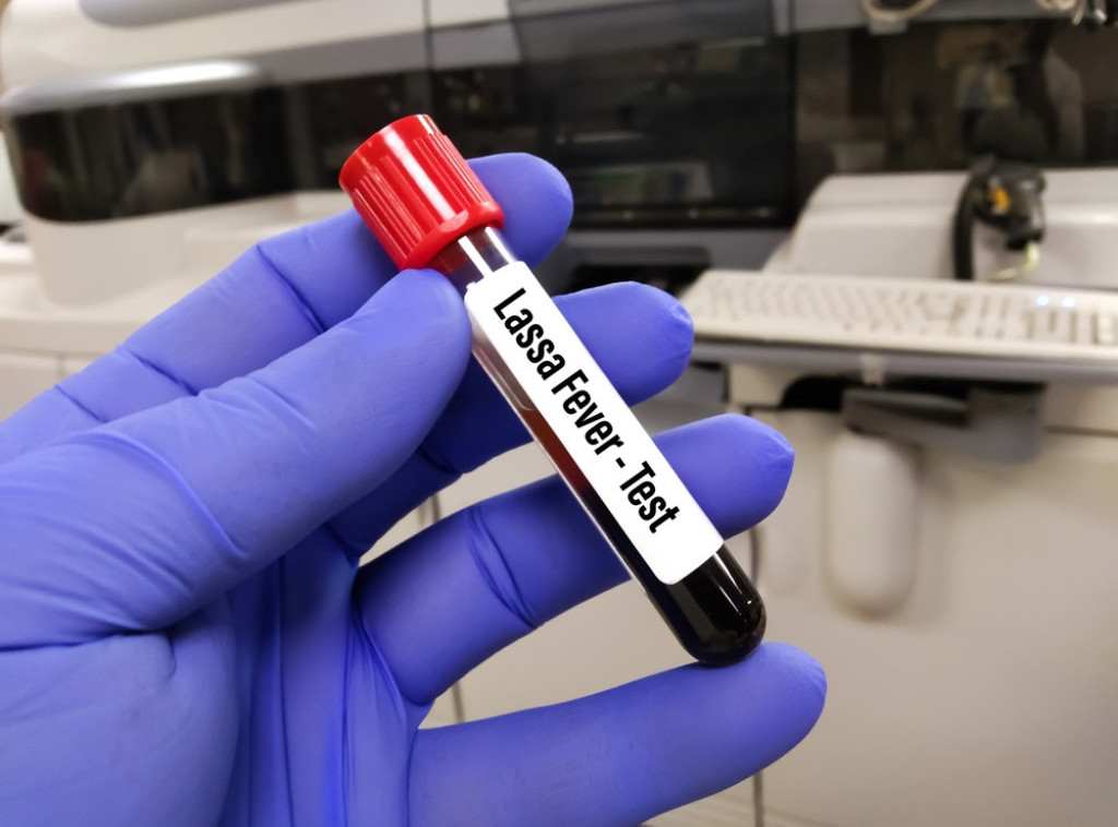 Lasa groznica se širi velikom brzinom u Nigeriji, upozoravaju zdravstvene vlasti