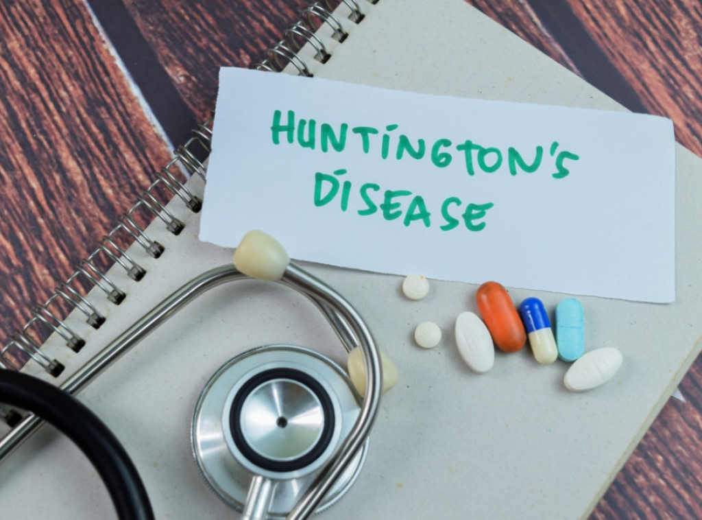 BBC: Hantingtonova bolest prvi put uspešno izlečena