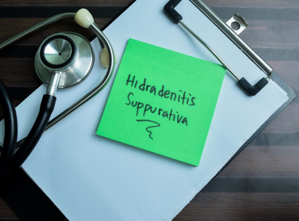 Hidradenitis supurativa - kožno oboljenje koje pogađa pretežno mlade ljude