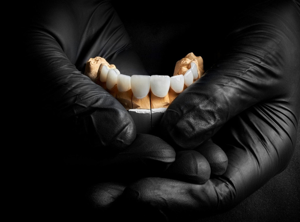 Naučnici pronašli način da smanje rizik od odbacivanja zubnih implantata