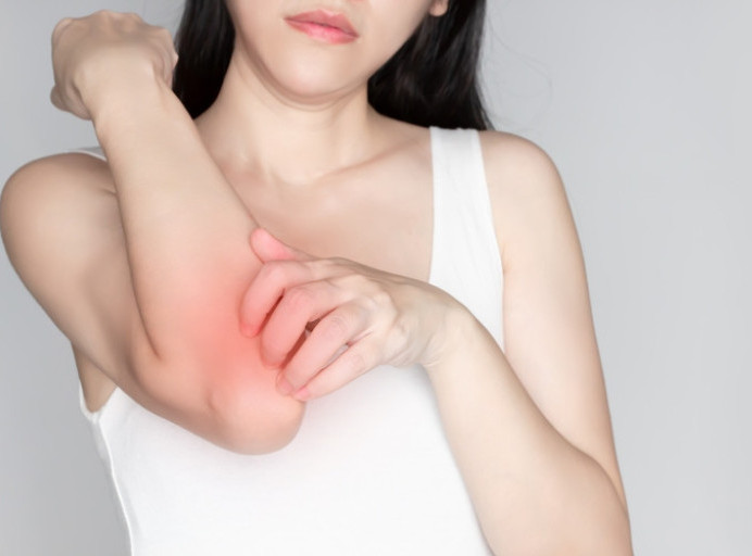 Hrvatska: U Dubrovniku zabeležena tri slučaja šuge