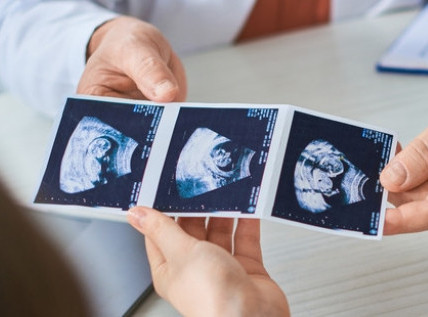 Grad Čačak izdvojio dva miliona dinara za pomoć vantelesnoj oplodnji