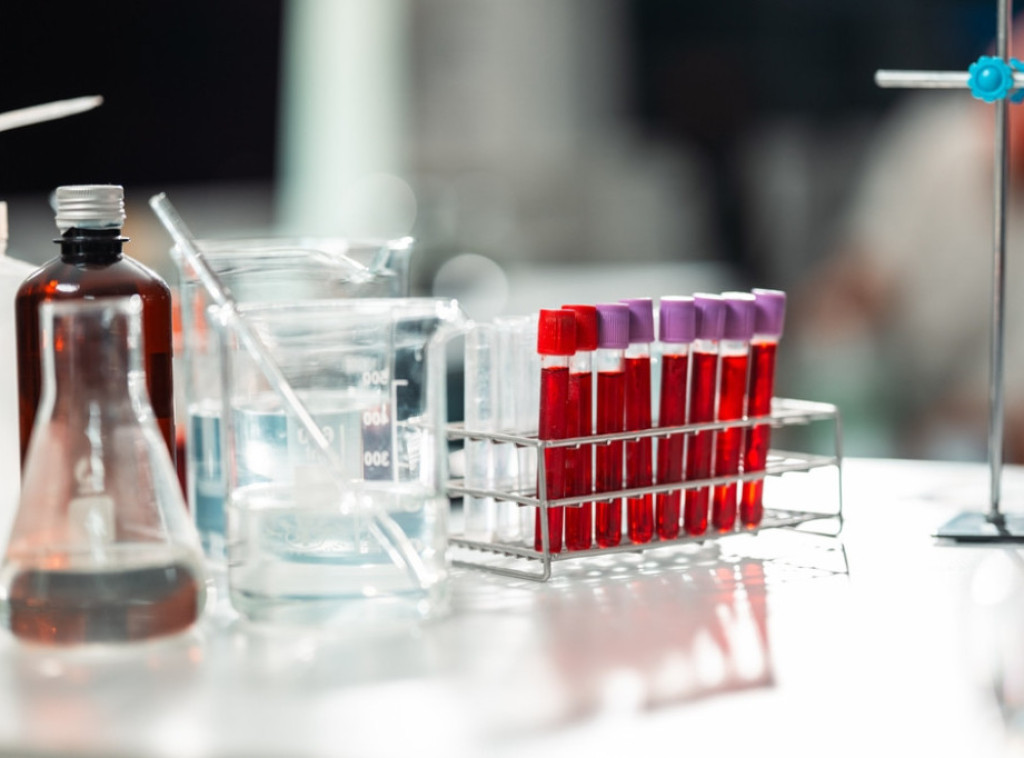 Vareš: Prisustvo olova u krvi pronađeno kod još 100 testiranih osoba