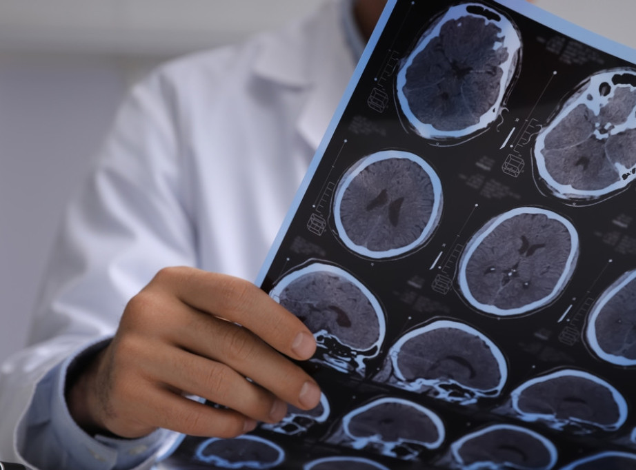 Studija objašnjava zašto kod nekih ljudi sa starenjem mozak ostaje očuvan