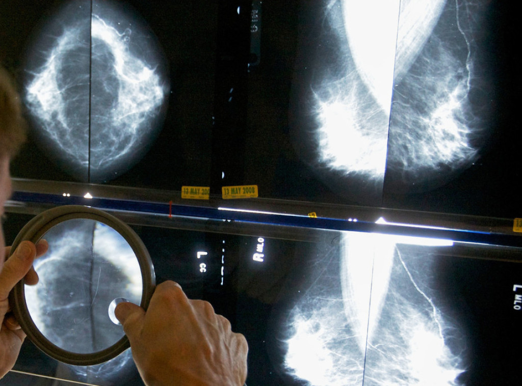 Francuska: Skoro 70.000 smrtnih slučajeva zbog duvana, veliki teret za javno zdravlje